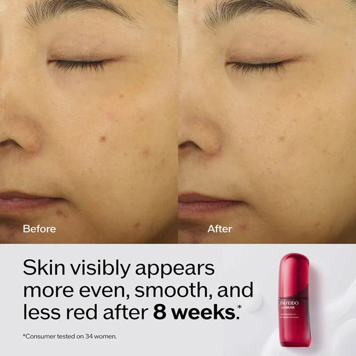 SHISEIDO Ultimune Power Infusing Serum