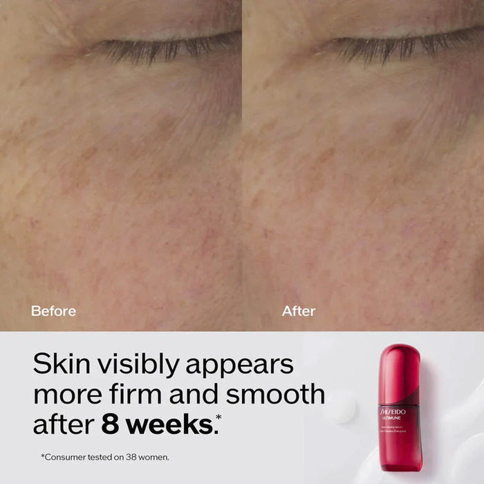 SHISEIDO Ultimune Power Infusing Serum
