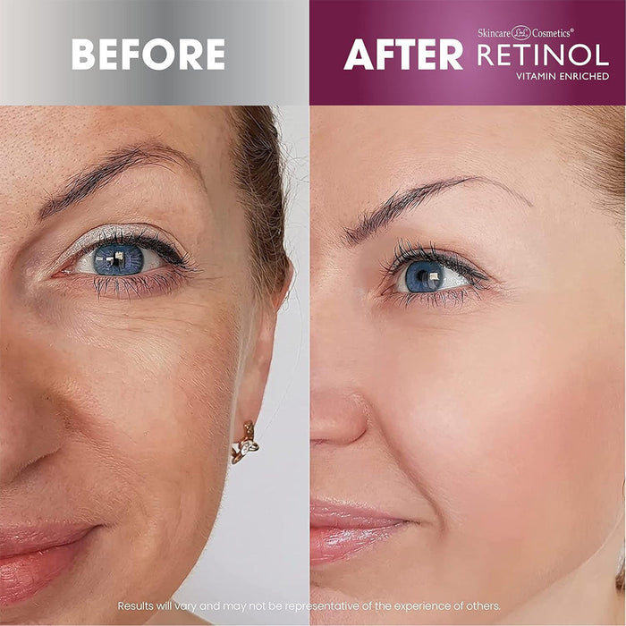 SKINCARE Retinol Super Face Lift 30G